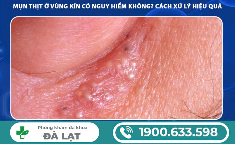 Block Image